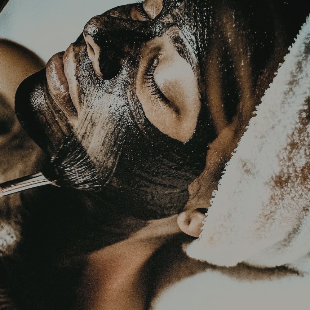 Láser carbon peel