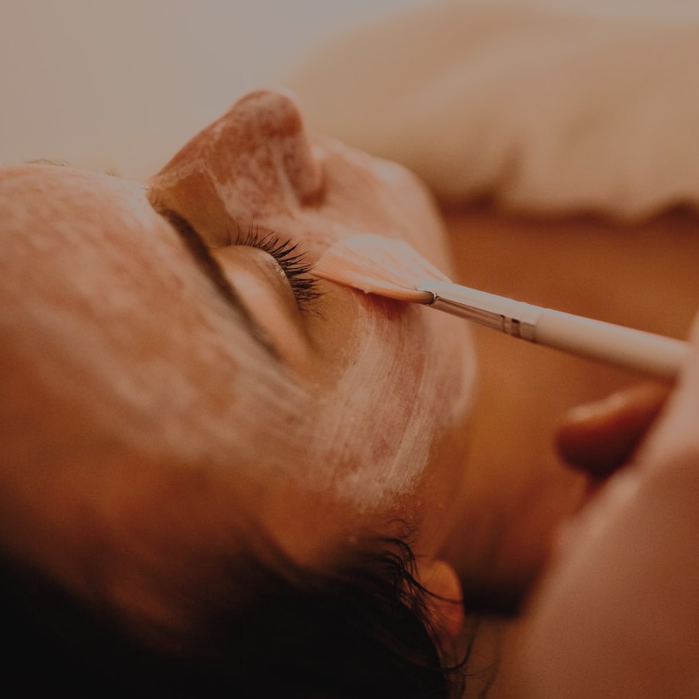 Peeling químico